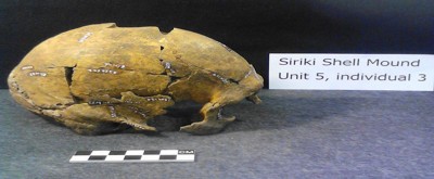 Figure 5. Lateral view of skull of individual 3.